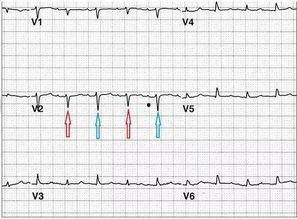 心电图教学视频全集,全面解析心脏电生理奥秘