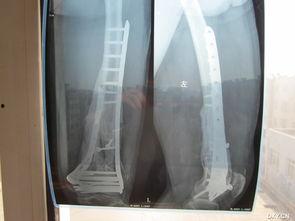 取钢板视频,钢板取材工艺全流程解析